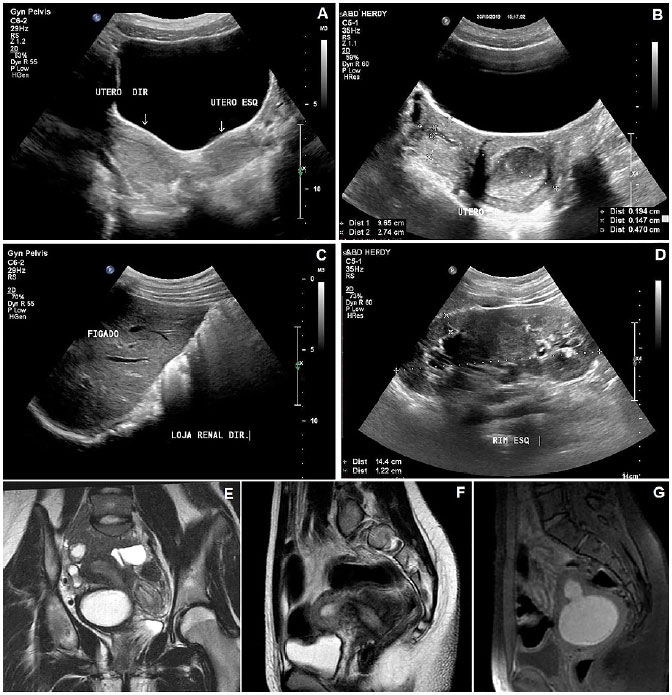 Malformações - Clínica Wajman - Cirurgias no útero
