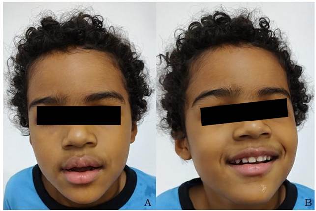 Criança sorrindo ao lado de menino
O conteúdo gerado por IA pode estar incorreto.