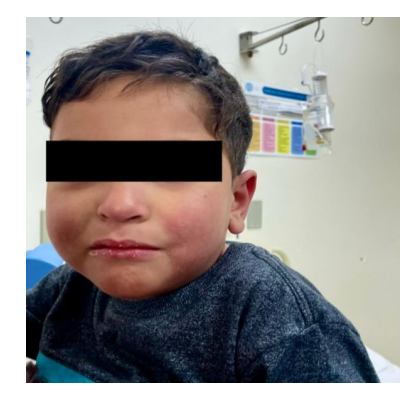 Criança com óculos de grau
O conteúdo gerado por IA pode estar incorreto.